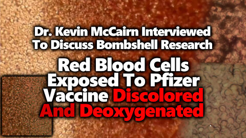 Effect of Pfizer Vaccine On Human Blood: Interview With Kevin McCairn & Recap Of Research