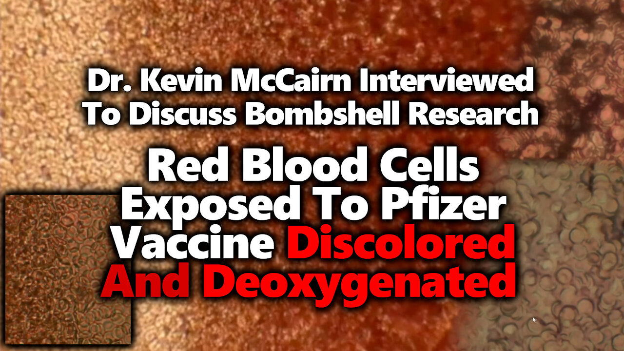 Effect of Pfizer Vaccine On Human Blood: Interview With Kevin McCairn & Recap Of Research