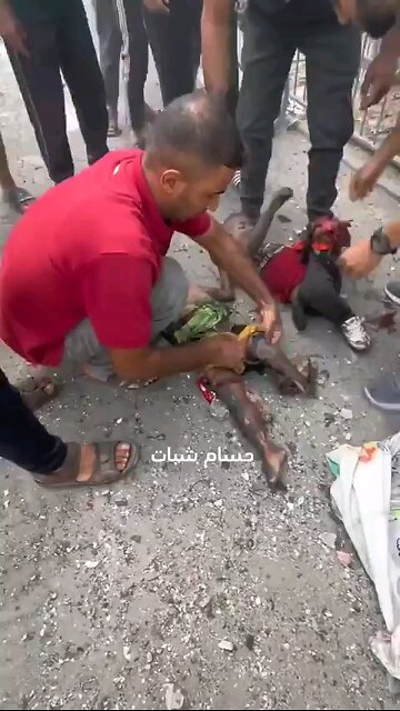 Dismembered babies dying on the streets in Gaza Palestine All those that support Israel support this