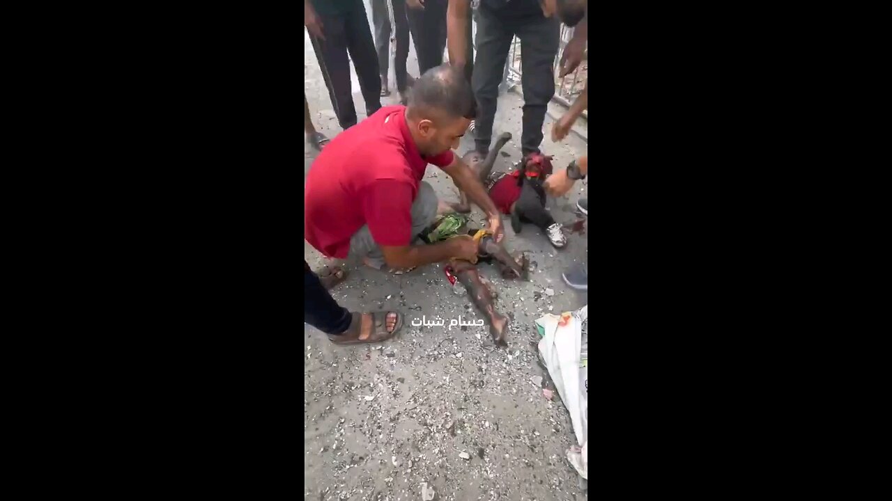 Dismembered babies dying on the streets in Gaza Palestine All those that support Israel support this
