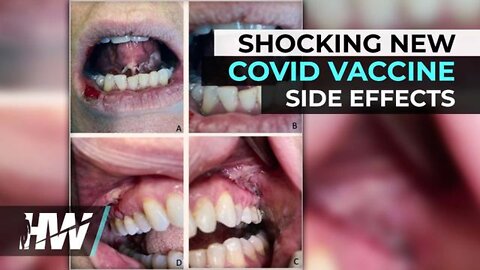 THE HIGHWIRE 3/25/22 - SHOCKING NEW COVID VACCINE SIDE EFFECTS