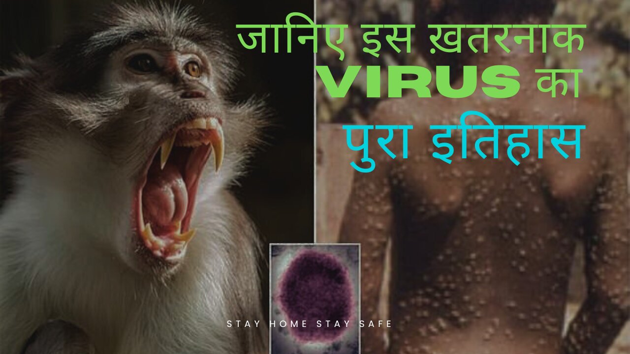 क्या हैं monkeypox जानिए इस का पुरा इतिहास