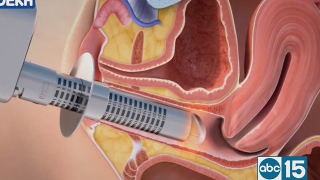 Dr. Deborah Wilson can help with the unpleasant symptoms of menopause
