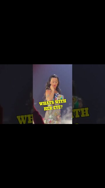 What's With Katy Perrys Eye?
