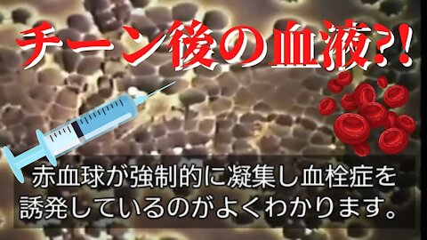 IMPORTANT!!!重要!!!ワクチン接種前後の血液の変化
