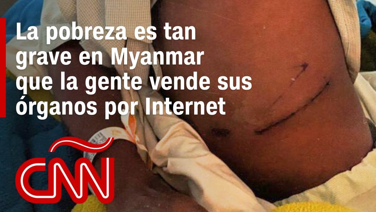 La pobreza es tan grave en Myanmar que la gente se ofrece a vender sus riñones por Internet