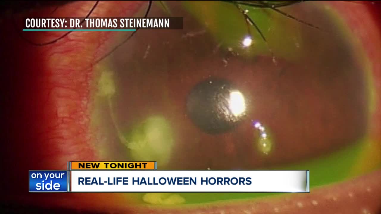 Doctors warn about costume pieces that are illegal or create allergic reactions sold online