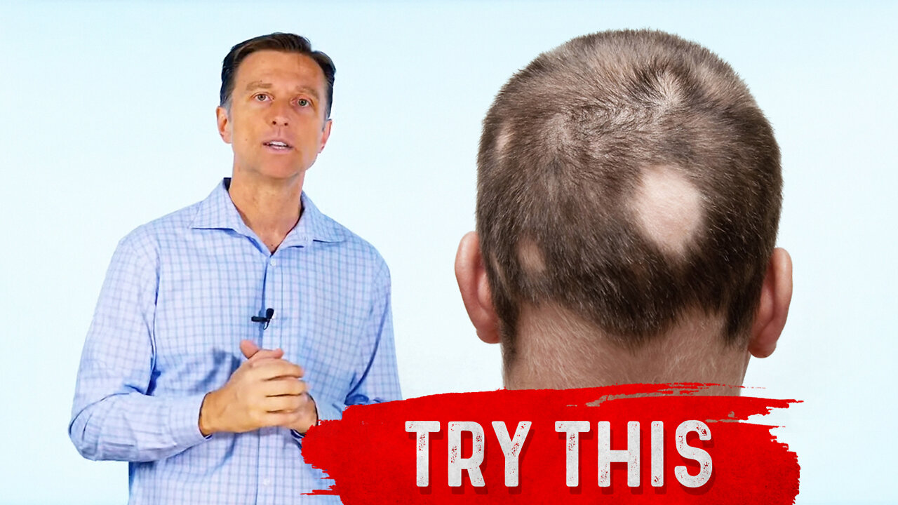 The 11 Types of Alopecia (AND HOW TO FIX IT) - Dr. Berg