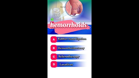 Hemorrhoids question answers mcqs #Hemorrhoids #constipation #ruberbandlagation
