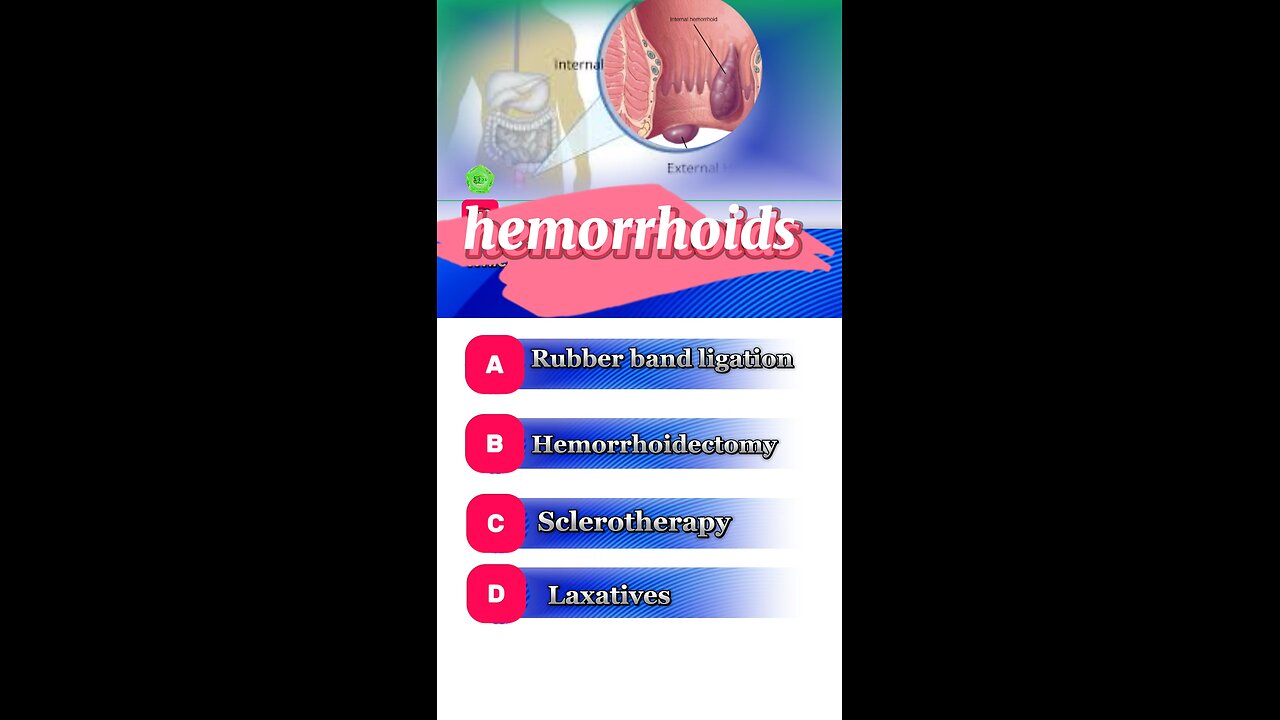 Hemorrhoids question answers mcqs #Hemorrhoids #constipation #ruberbandlagation