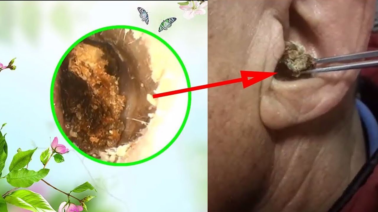 Ear Cleaning with Relaxing Music #06