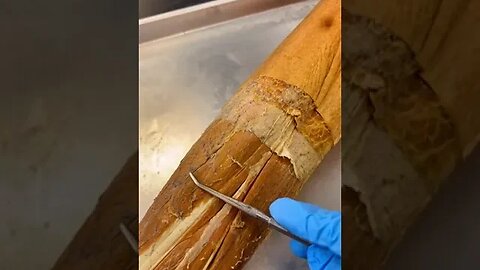 Layers of a Real Human Leg