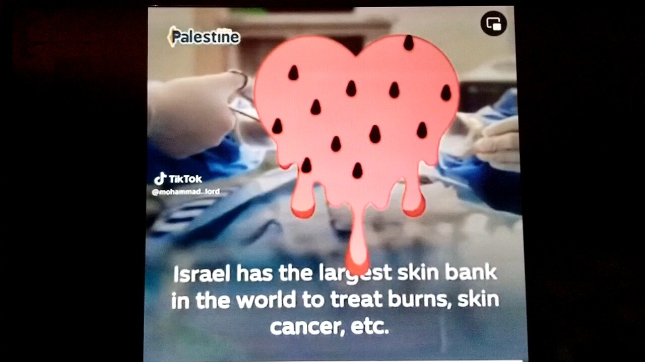 Israel' skin Bank?