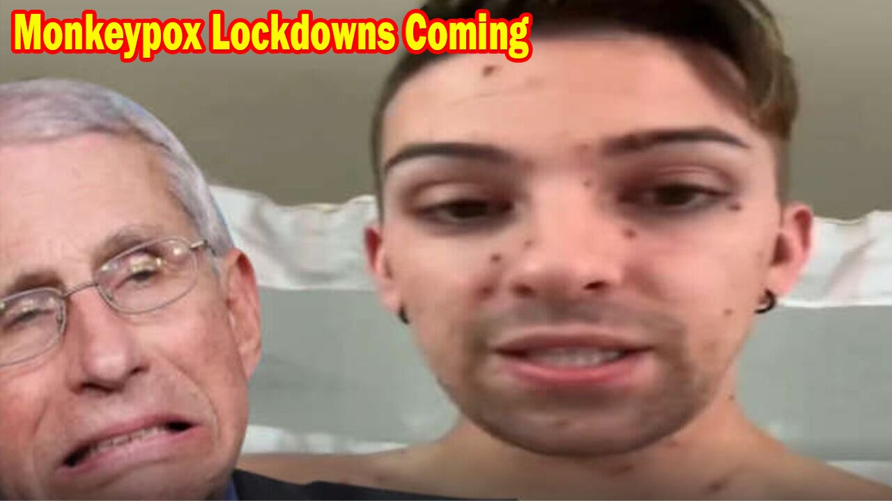 Salty Cracker: Monkeypox Lockdowns Coming ReeEEeE Stream 08-16-24