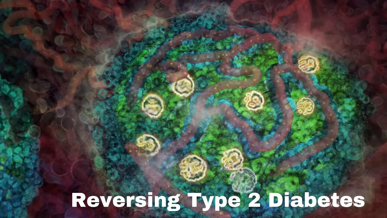 Reversing Type 2 Diabetes