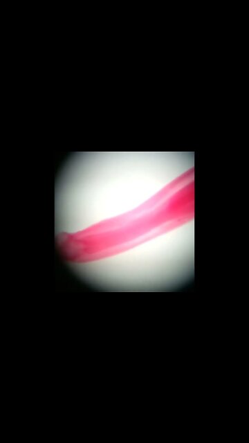 I know what a parasite looks like. lol! 🧐🧐