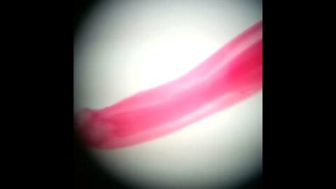 I know what a parasite looks like. lol! 🧐🧐