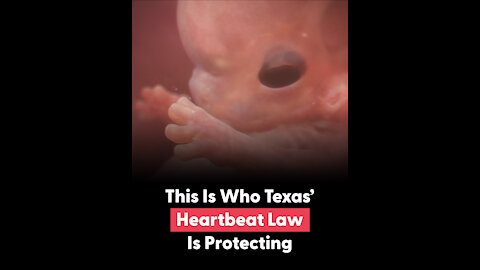 Texas' Heartbeat Law Is Protecting Babies Like Olivia