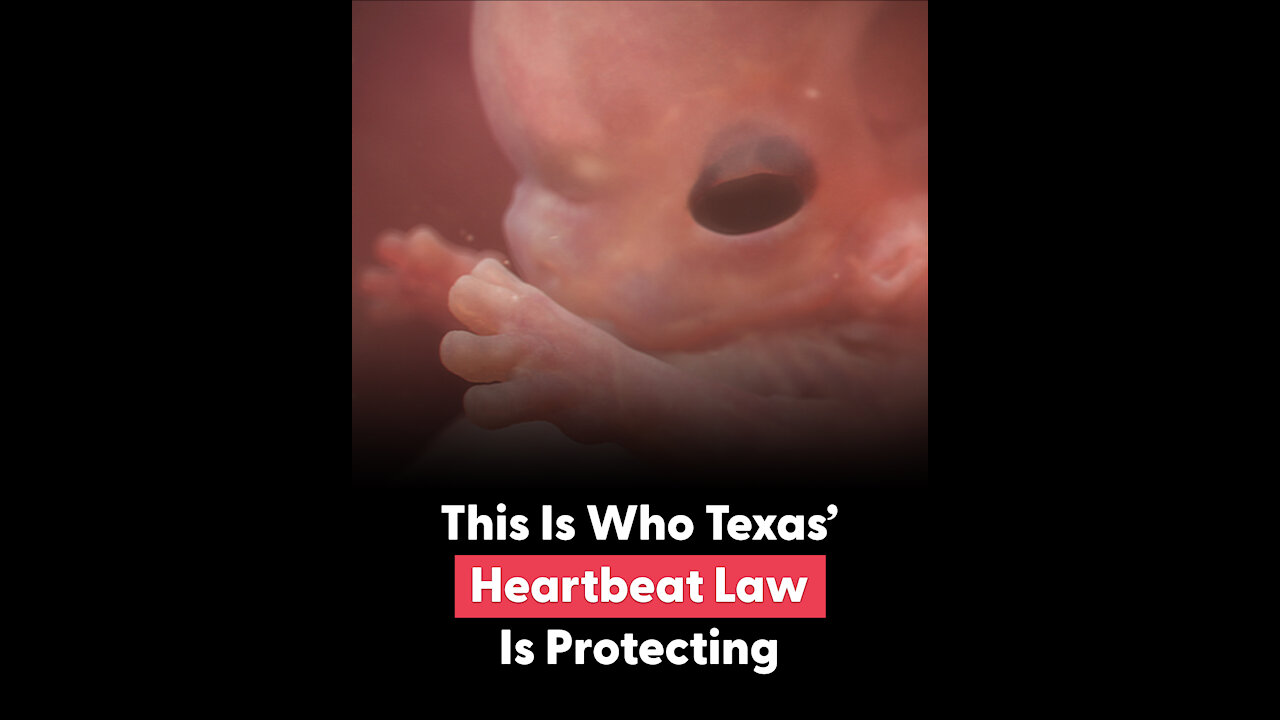 Texas' Heartbeat Law Is Protecting Babies Like Olivia