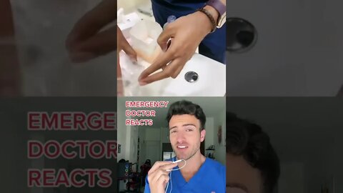 What To Do If Your Finger Gets Amputated: Fact Or Cap?