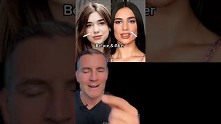 Celebrity Plastic Surgery Secrets✨Dua Lipa