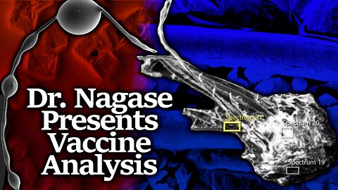 DR. NAGASE : VXXX ANALISIS