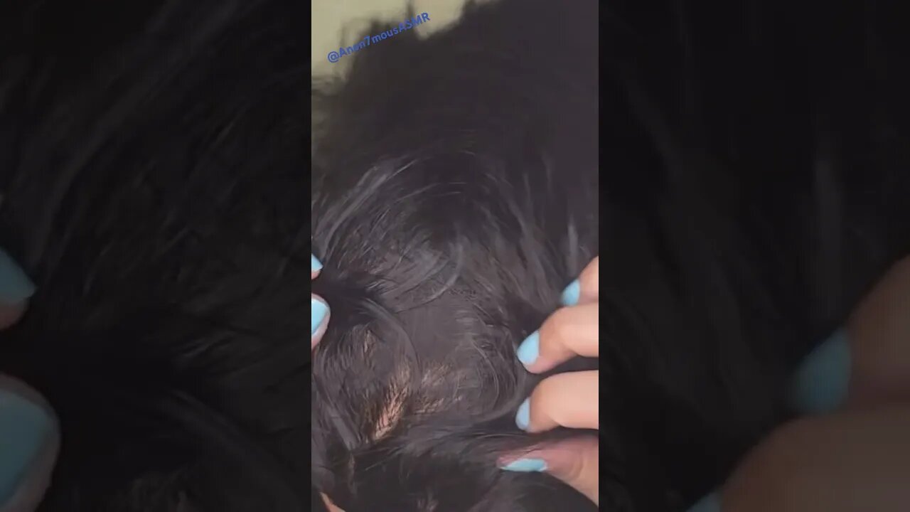 Scalp Massage Relieve Your Migraine💆🏽‍♀️ ~ASMR No Talking #asmr #asmrsounds #relaxing #asmrsound