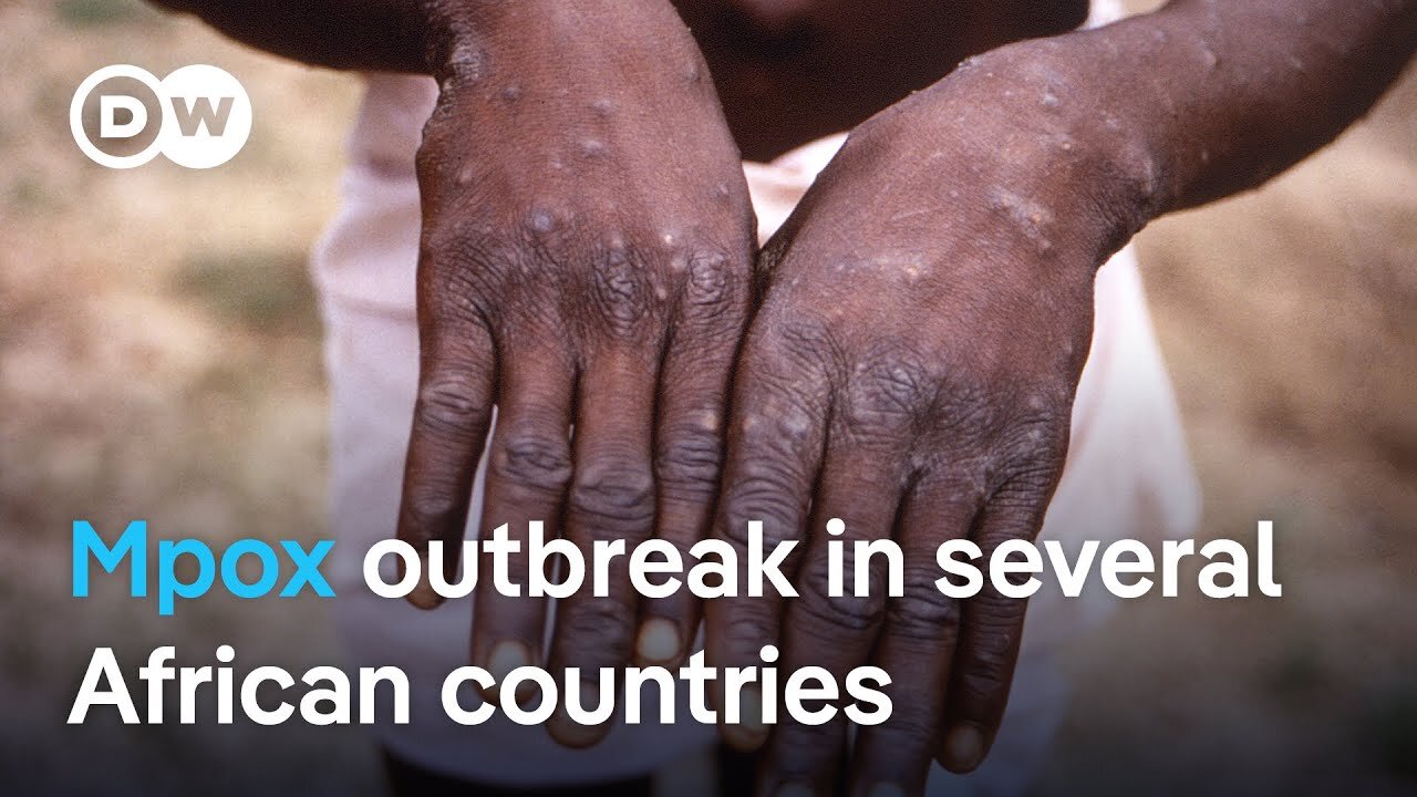 WHO declares global public health emergency following Mpox outbreak | DW News