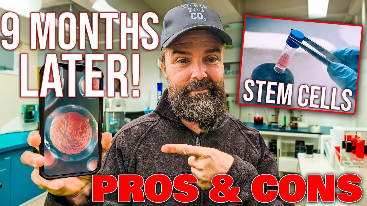 Stem Cell Therapy • 9 Months Later • Did It WORK? • Pros & Cons To Stem Cell Therapy