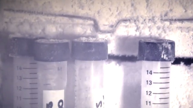 'That's totally fraud': A leading stem cell expert responds to a FL clinic's stem cell pitch
