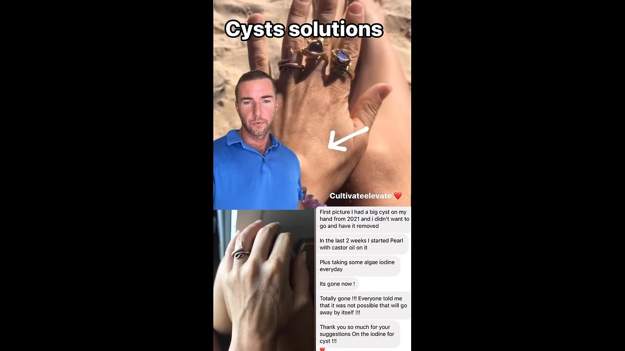 Cyst Solutions