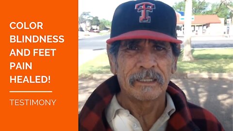 ► JESUS HEALS MARIO ◄ Color Blindness and Feet Pain Healed!