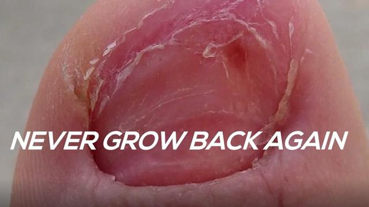 3-MINUTE SHOWER HACK FLUSHES AWAY FUNGUS IN SECONDS