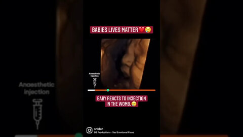 Babies lives matter.❤️👶 #shorts