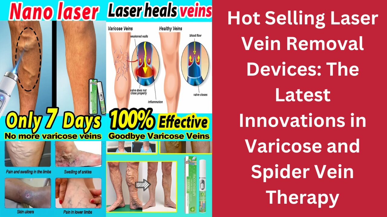 Hot Selling Laser Vein