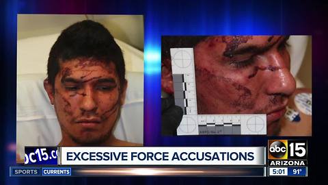 More excessive force by Mesa Police?