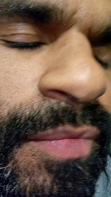 self healing process