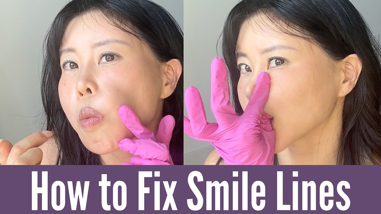 How to fix smile lines | Koko Face Yoga