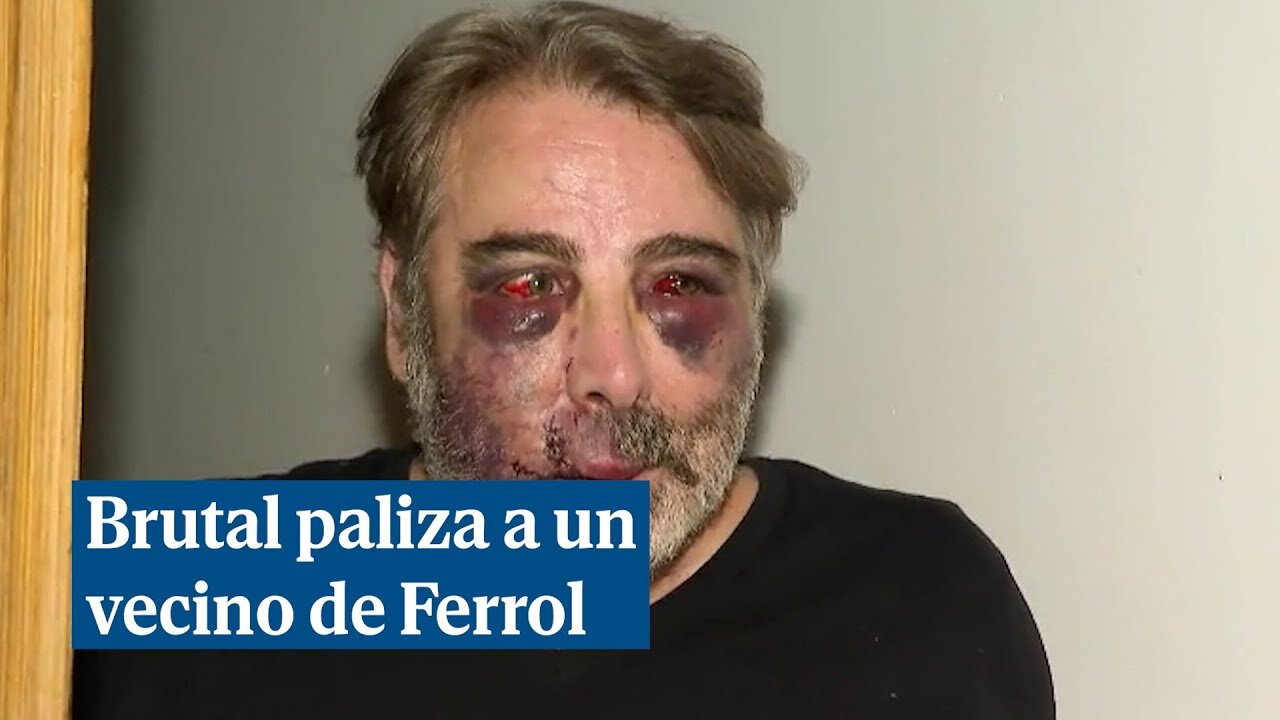 Apalean salvajemente y en su propia casa a un hombre por pedir a unos jóvenes que no hicieran ruido