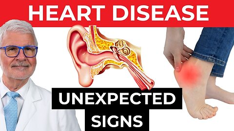 OVERLOOKED Signs Of Heart Disease, DO NOT IGNORE | Dr. Gundry