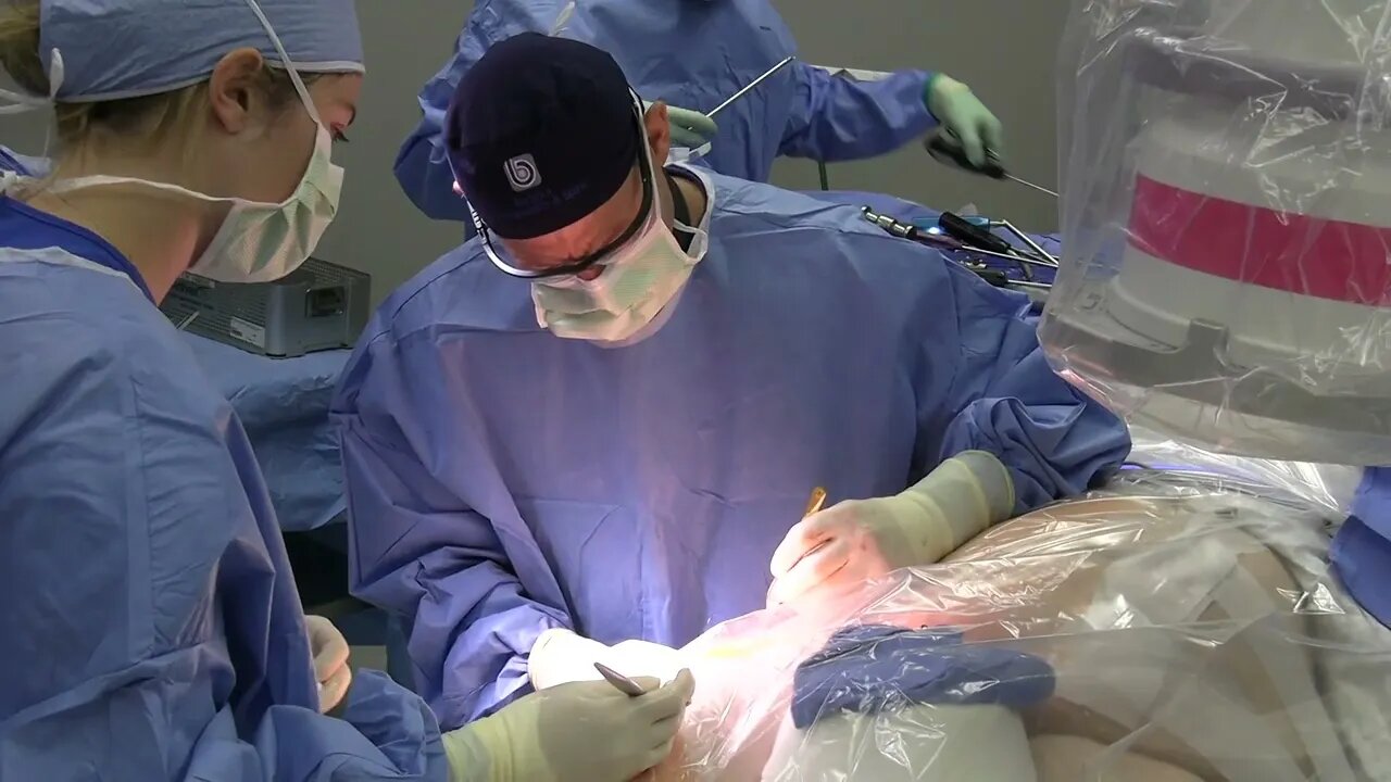 Hip arthroscopy - Scott A. Barbour, M.D.