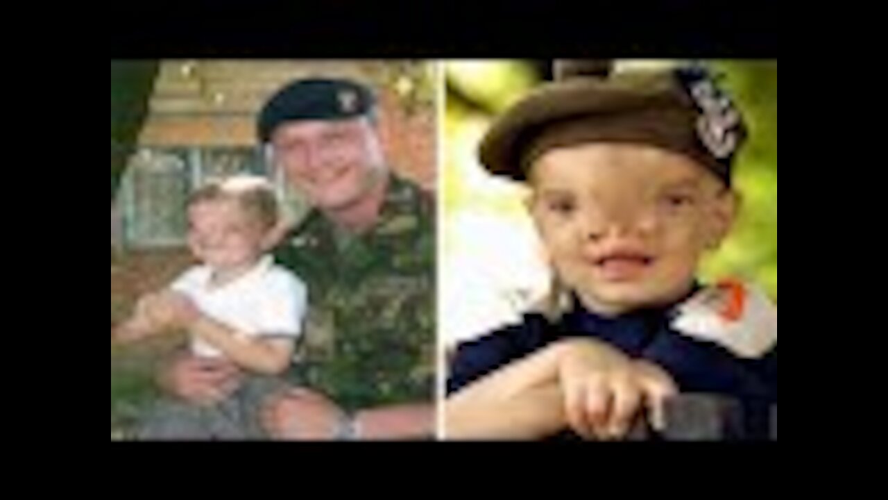 He was called the "little monster"...Brit soldier who raised £140,000 to help pay for life-changing