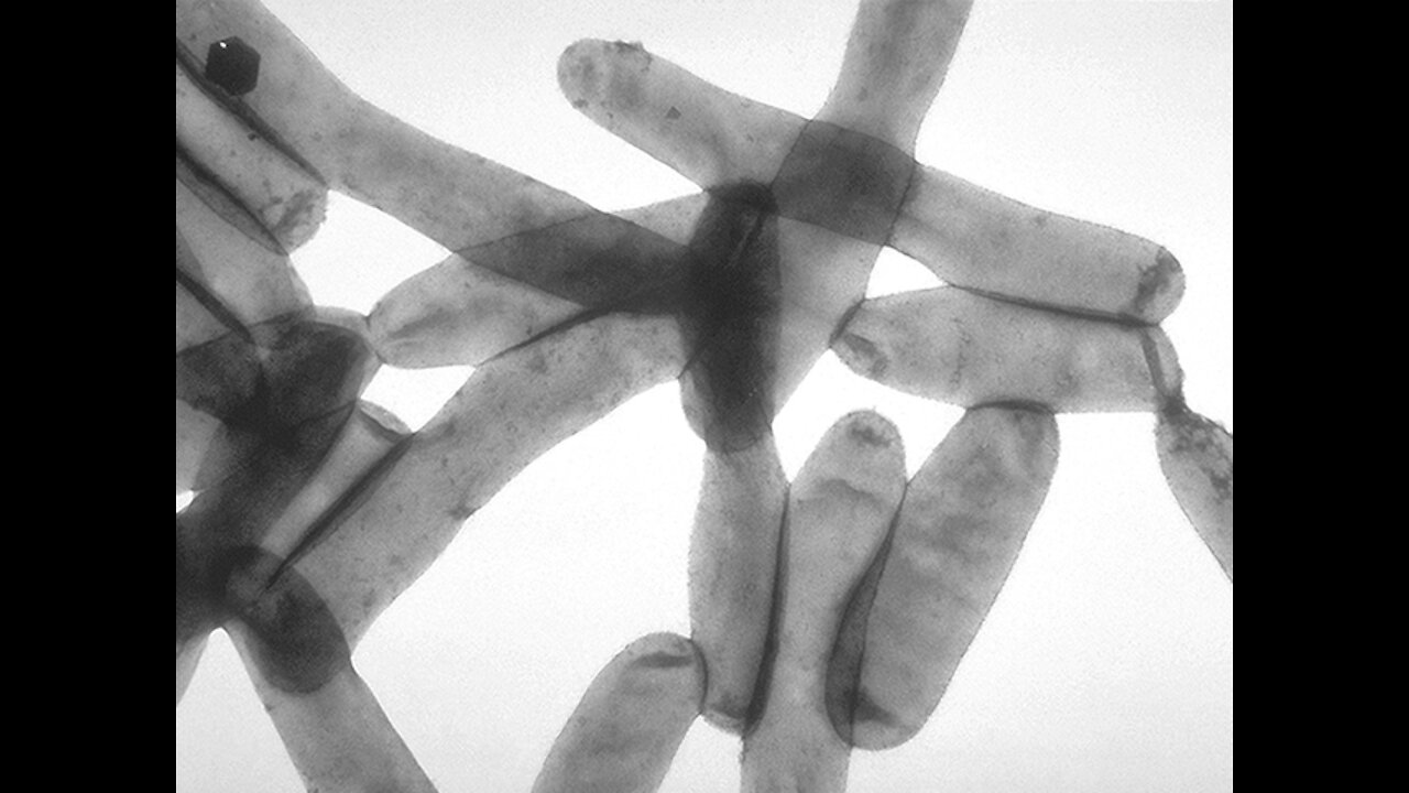 MDHHS reports increase in Legionnaires’ disease in Michigan