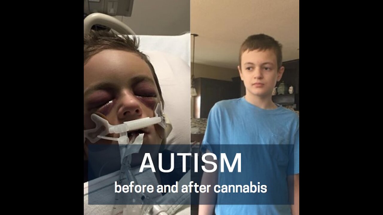 Episode 118: Cannabis Nothing Short of Miracle For Boy With Severe Autism And Seizure Disorder