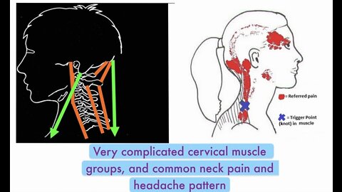 Head Spa: your home headache acupressure therapy