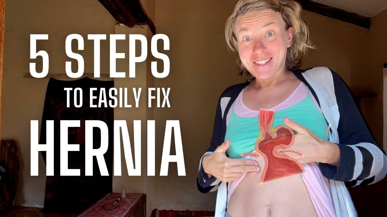 5 Simple Steps I Used to Heal Hiatal Hernia Naturally at Home