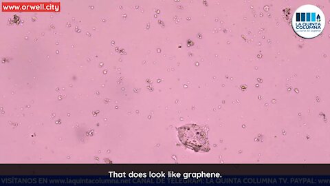 More videos on unknown elements found in COVID vaccination vials