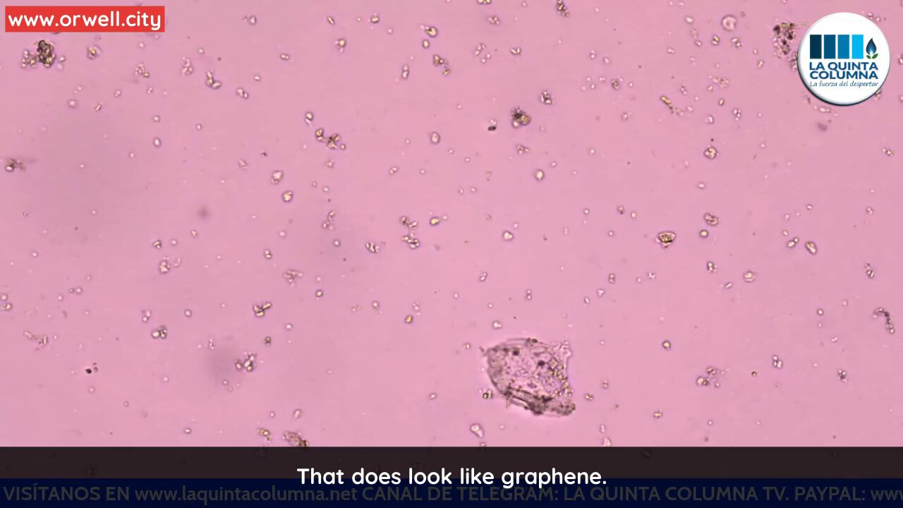 More videos on unknown elements found in COVID vaccination vials