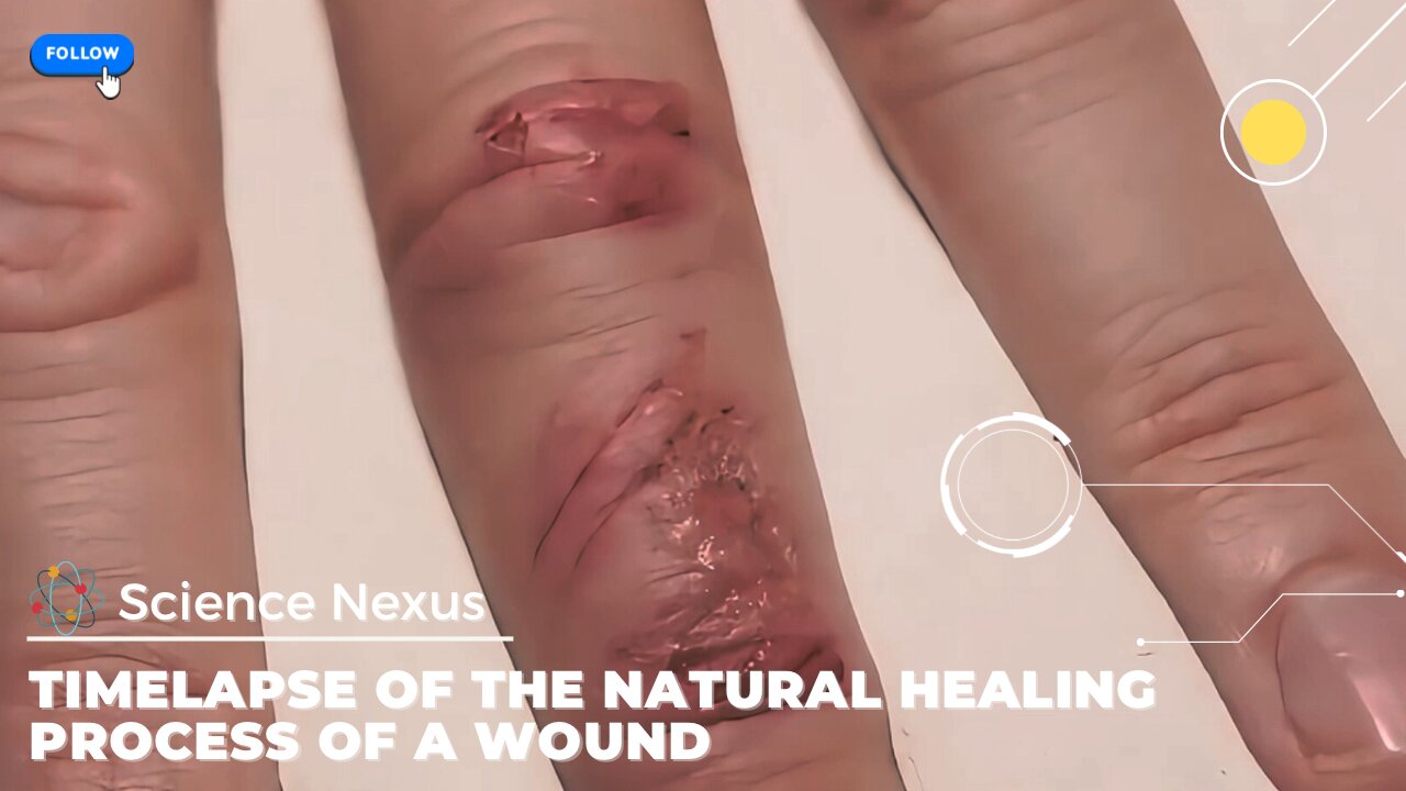 Timelapse of a wound’s natural healing process