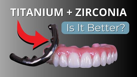 Discover the Benefits of Titanium For A Stronger Smile | All On 4 Full Mouth Dental Implants